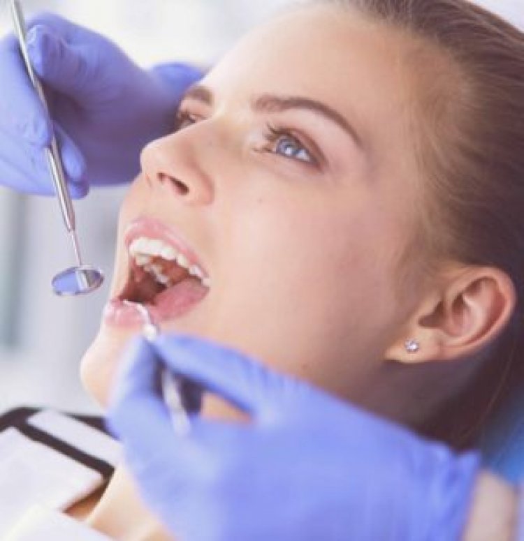 Why You Should Consider Dental Veneers