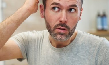 How to Conceal the Fact that you had Hair Transplant