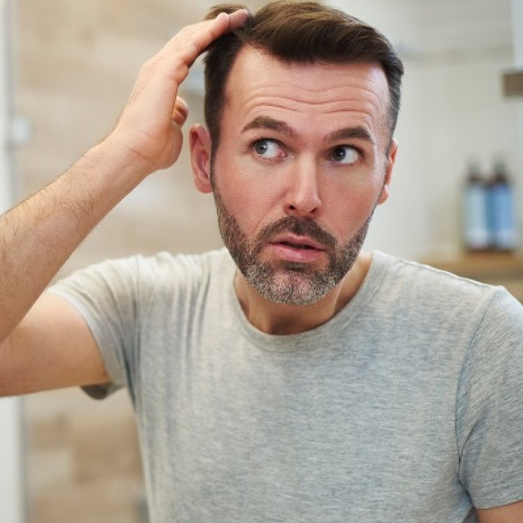 How to Conceal the Fact that you had Hair Transplant