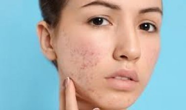 Exploring the Treatment Options in Dubai