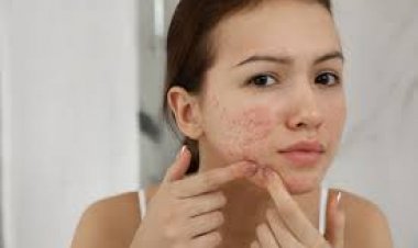The Impact of Treating Skin Conditions in Dubai