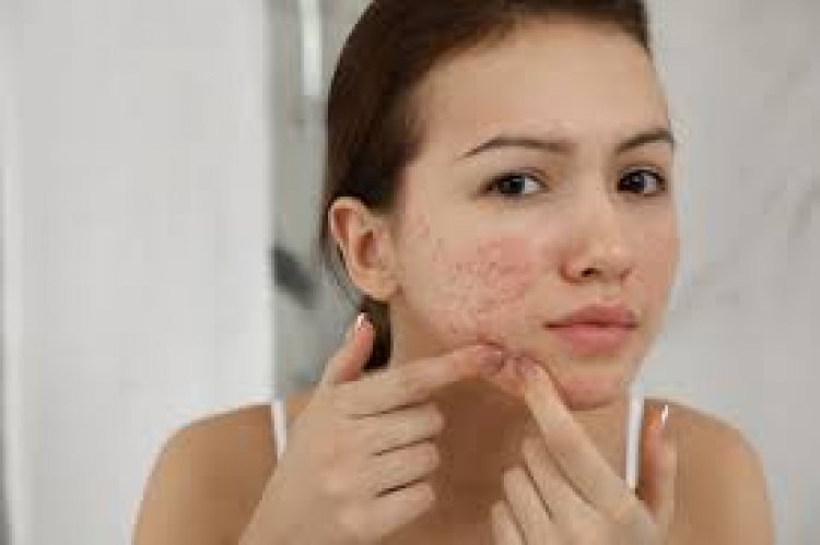 The Impact of Treating Skin Conditions in Dubai