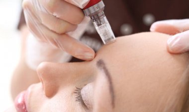 Unlock Radiant Skin: The Ultimate Guide to Microneedling with PRP Therapy in Riyadh!