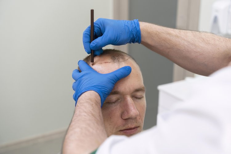 Riyadh's Hair Renaissance: PRP Therapy and Its Growing Popularity