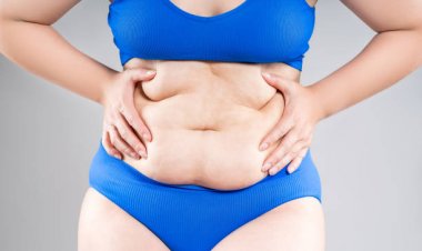 Enhance Your Contours: Abdominoplasty in Riyadh