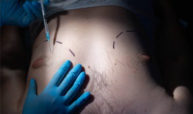 Empower Your Appearance: Inverted Nipple Surgery Riyadh