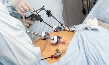 Weight Loss Redefined: Endoscopic Balloon in Riyadh