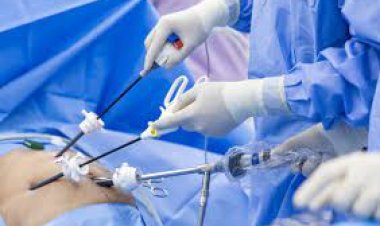 The Rise of Laparoscopic Surgery: A New Era in Healthcare