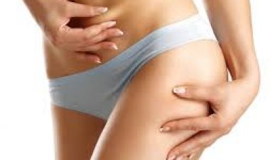 Is Vaser 4D Liposuction Right for You? Find Out Here