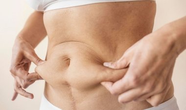 A Comprehensive Look at Lipo Abdominoplasty in Islamabad