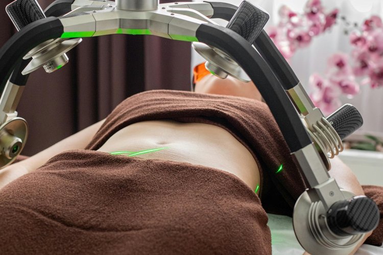 Islamabad Liposuction: Cost of Revisional Surgery