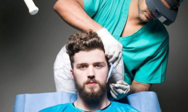 Patient Reviews: Beard Transplants in Riyadh