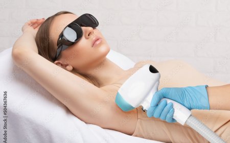 Benefits of Laser Hair Removal in Riyadh's Top Treatments