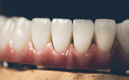 ابتسامة مشعة مع زركونيا كراون في الرياض