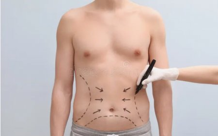 Is VASER Liposuction in Riyadh Right for You