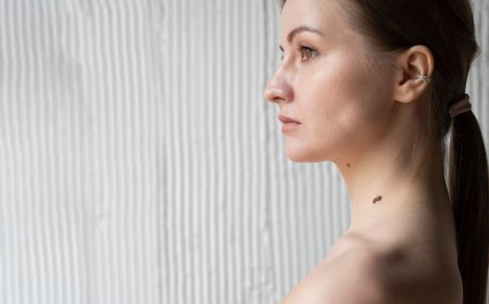 Say Goodbye to Skin Tags with Modern Removal Techniques