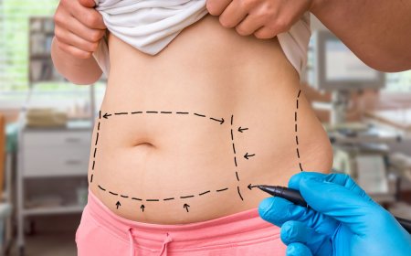 Non-Surgical Alternatives to Tummy Tuck in Islamabad