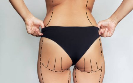 Discover Non-Surgical Thigh Lifting in Riyadh for a Sleek Look