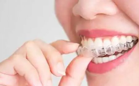 Breaking Down Invisalign Costs in Mississauga: Is It Worth It?
