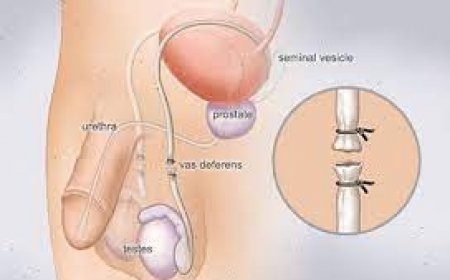 Discover the Best Premature Ejaculation Treatment in Riyadh