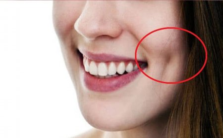 Dimple Surgery in Riyadh: Is It Safe?