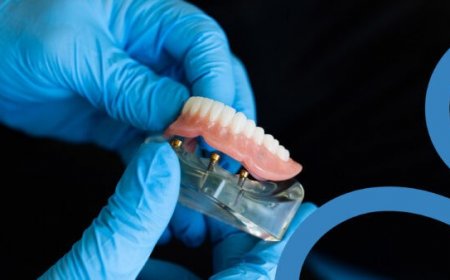 Affordable Root Canal in Houston: A Comprehensive Guide to Dental Care and Mobile Denture Services