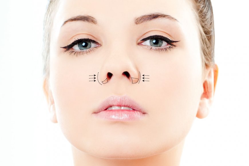 Discover the best alarplasty clinics in Riyadh