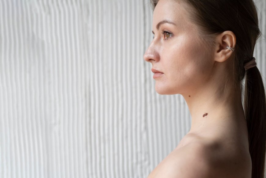 Say Goodbye to Skin Tags with Modern Removal Techniques