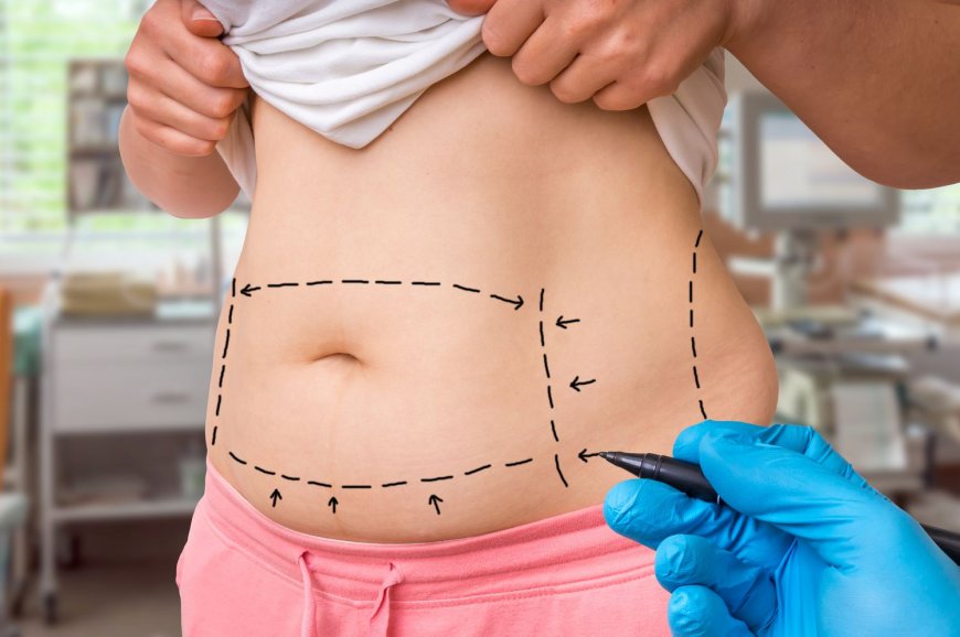 Non-Surgical Alternatives to Tummy Tuck in Islamabad
