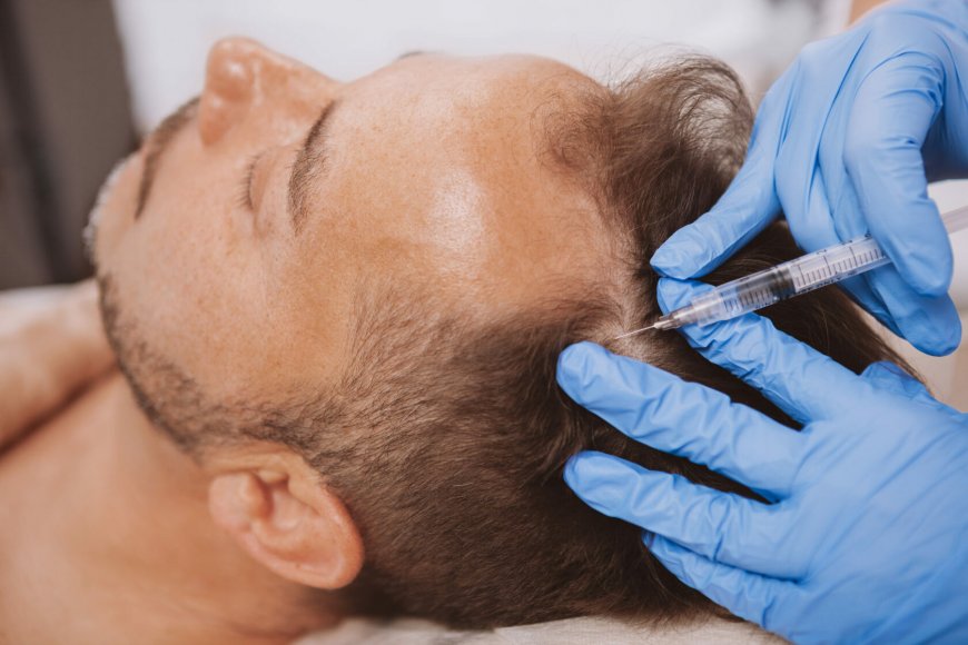 The Latest Hair Transplant Technologies in Riyadh