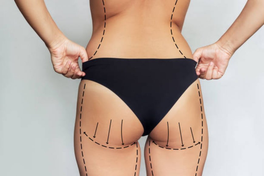 Discover Non-Surgical Thigh Lifting in Riyadh for a Sleek Look