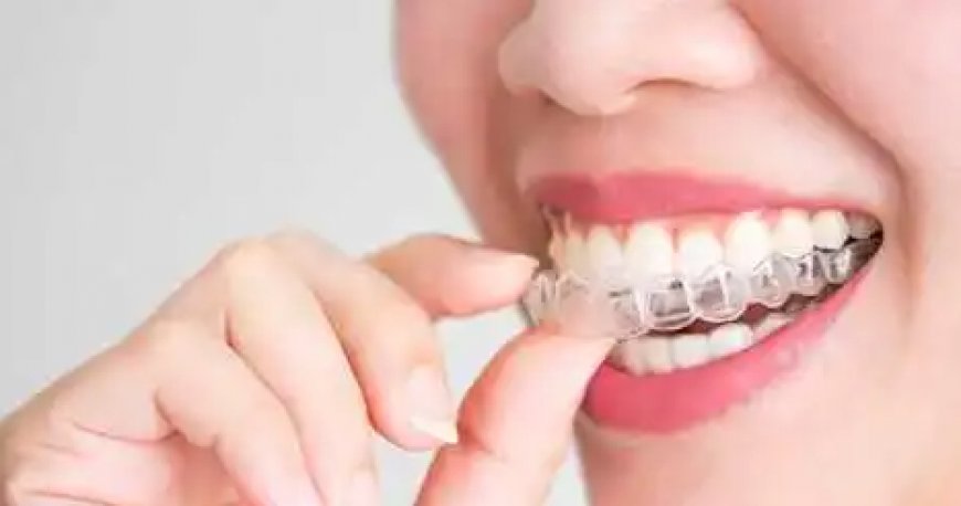 Breaking Down Invisalign Costs in Mississauga: Is It Worth It?