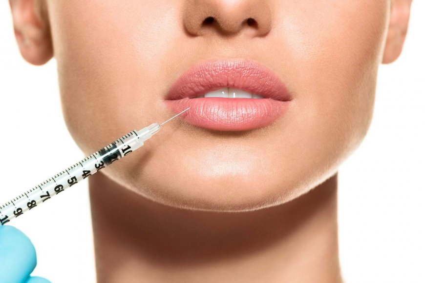 Russian Lip Filler Trends in Riyadh: What’s Popular in 2025?