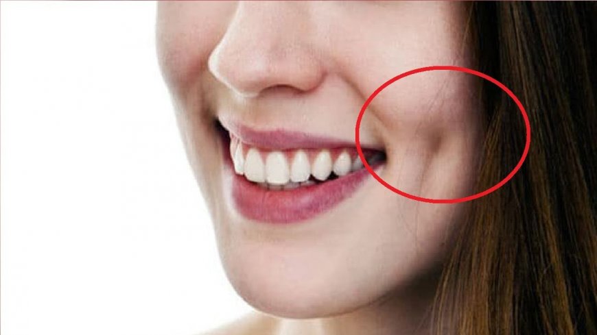 Dimple Surgery in Riyadh: Is It Safe?