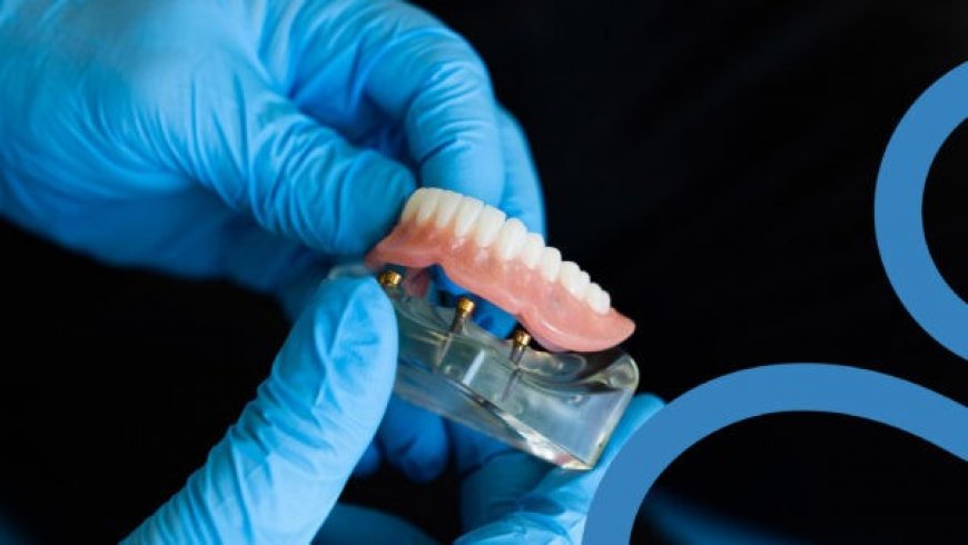 Affordable Root Canal in Houston: A Comprehensive Guide to Dental Care and Mobile Denture Services