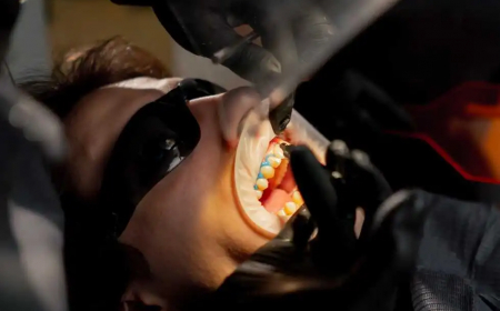 Achieve a Radiant Smile with a Professional Teeth Whitening Dentist in Mississauga