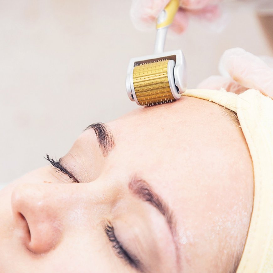 Is Derma Rolling Safe? Experts in Riyadh Weigh In