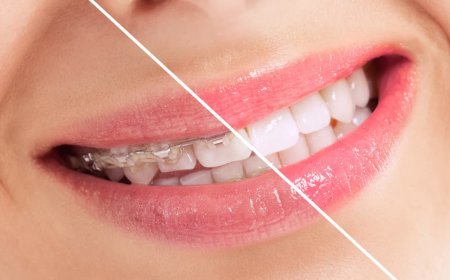 Why Teeth Straightening is More Than Just a Cosmetic Fix