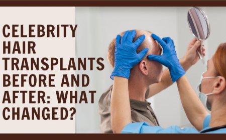 Celebrity Hair Transplants Before and After: What Changed?