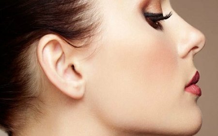 Is Rhinoplasty Permanent? When Do You Need a Revision?