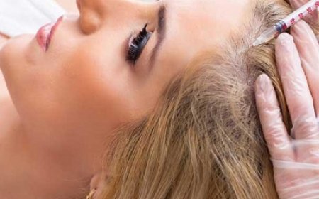 Can PRP treat all types of hair loss?