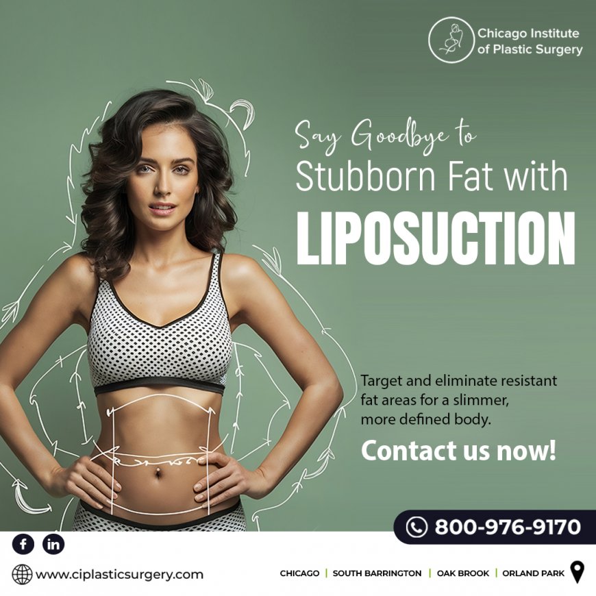 Liposuction in Chicago | Lipo in Chicago