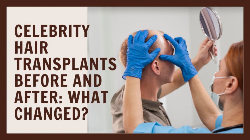 Celebrity Hair Transplants Before and After: What Changed?