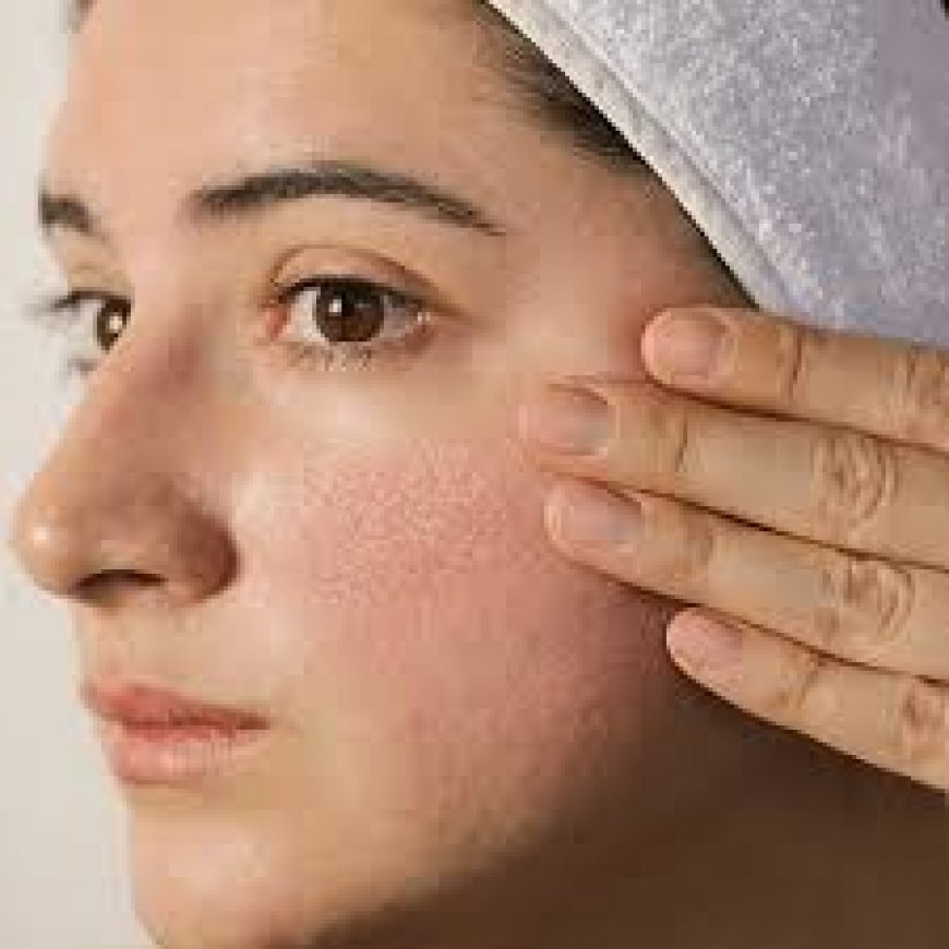 Effective Treatments for Large Pores in Islamabad: Achieving Smooth and Radiant Skin