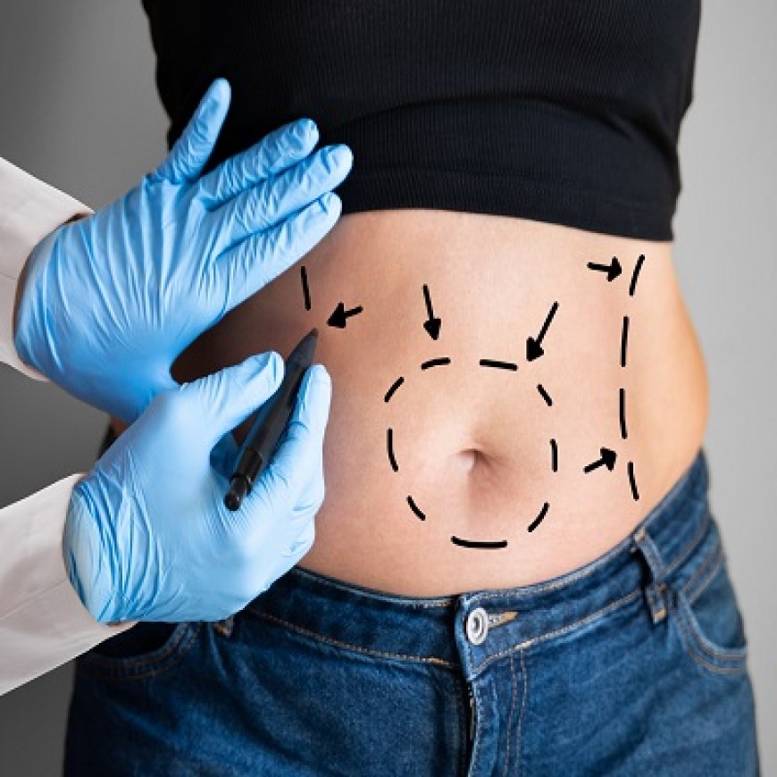 Types of Liposuction Procedures Available in Islamabad