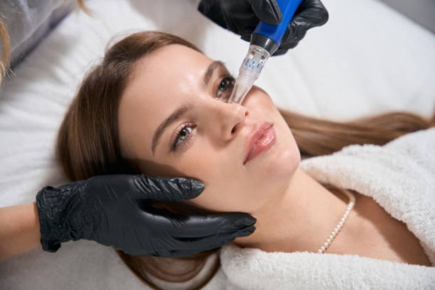 Derma Pen for Hair Growth – Fact or Fiction?