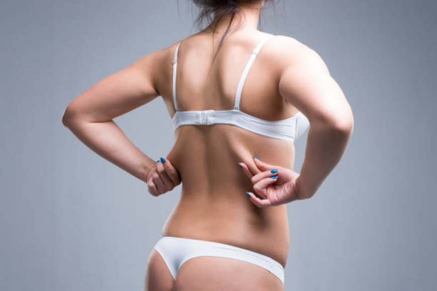 Why Riyadh is a Hub for Advanced Liposuction Treatments