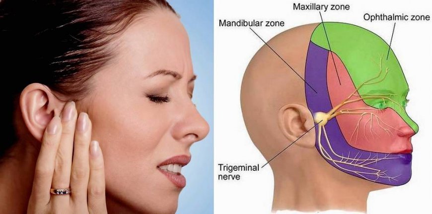 Trigeminal Neuralgia: How to Find the Right Treatment for Your Pain