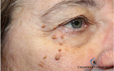 When Can You Wear Makeup Again After Eyelid Surgery?