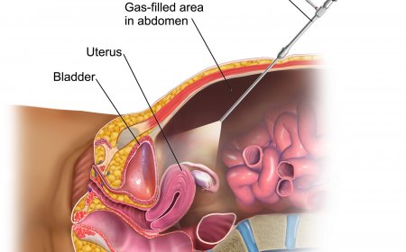 Top Rated Laparoscopic Clinics in Riyadh
